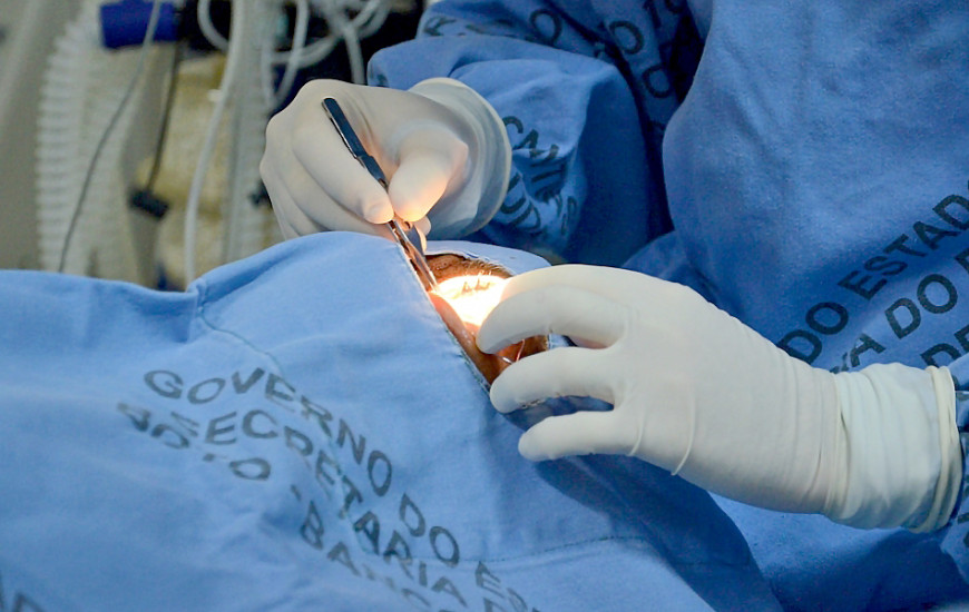 Procedimento cirúrgico de transplante de córnea
