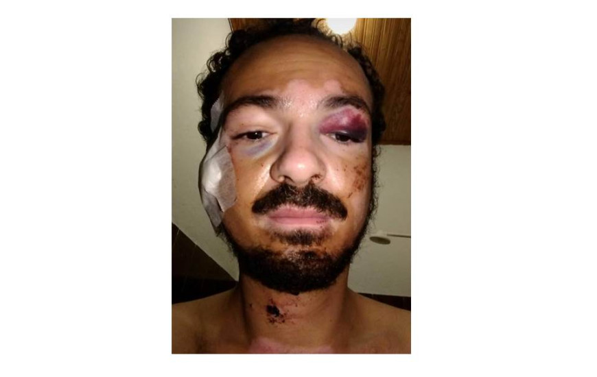 Jovem foi agredido antes da parada LGBTI, em Palmas