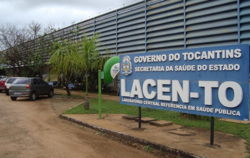 Laboratório Central de Saúde Pública do Tocantins (Lacen-TO).
