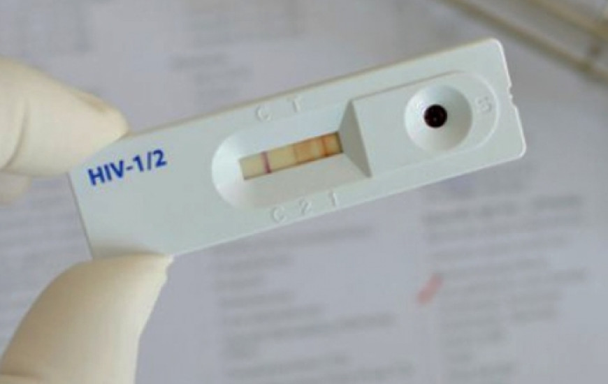 Diagnóstico rápido pode ajudar a aumentar o número de pacientes em tratamento