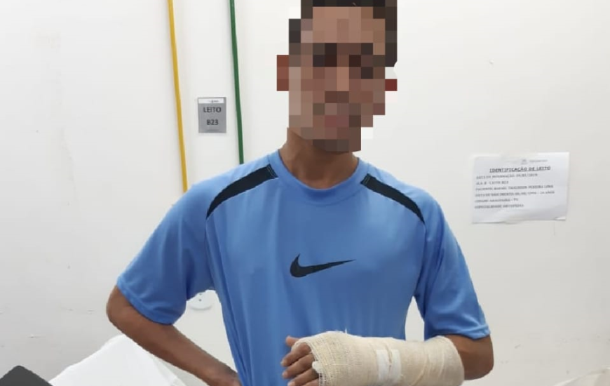 Pertences da vítima estavam escondidos no gesso do autor do furto