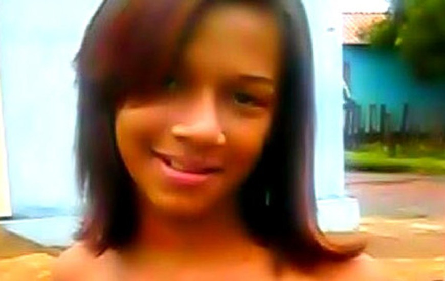 Jovem teve o rosto desfigurado em Araguaína