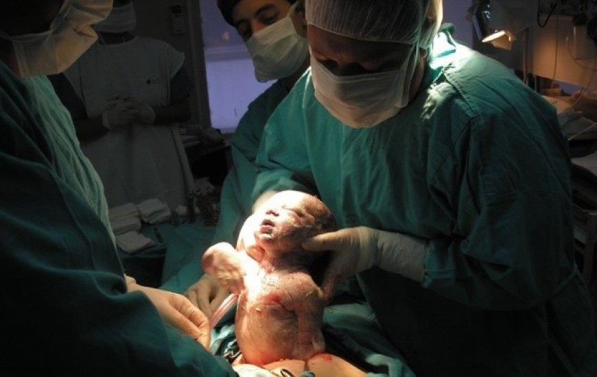 Partos cesáreas devem ficar mais restritos