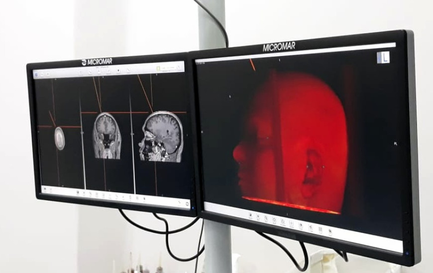 Cirurgia no HGP com paciente acordado