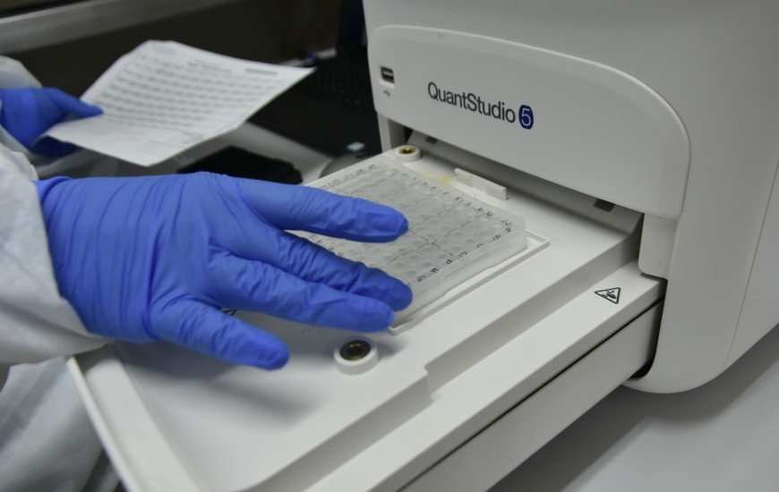 Foto: Divulgação/SES-TO