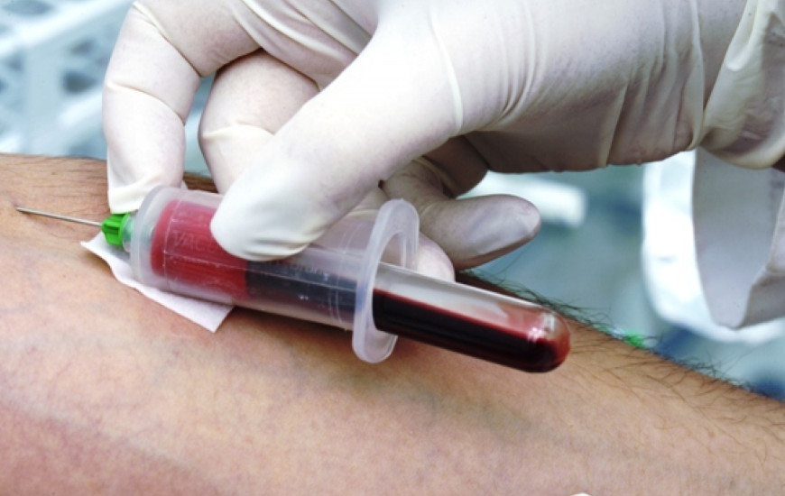 Com a pandemia houve redução nos cadastros de medula óssea.