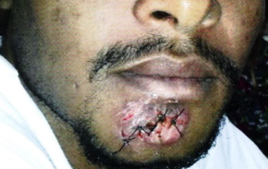 Agentes estariam atingindo detentos