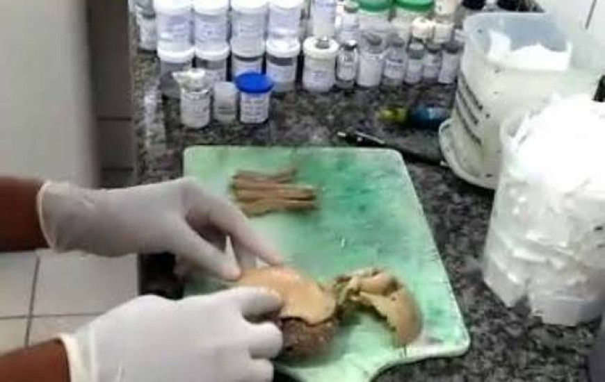 Exames descartam material humano