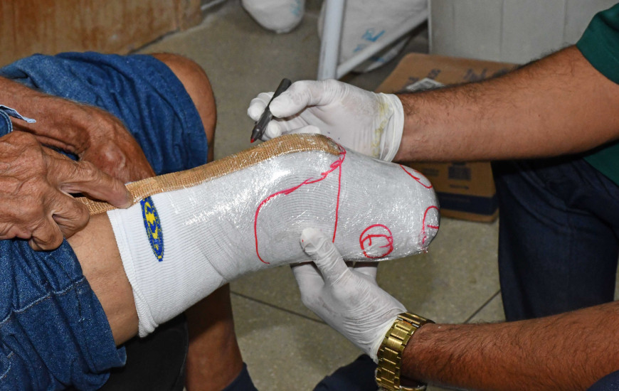 SES-TO informa que há outros fornecedores contratualizados