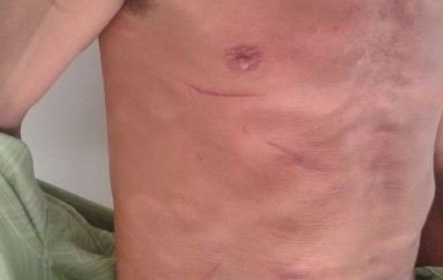 Trabalhadores são agredidos por homens encapuzados